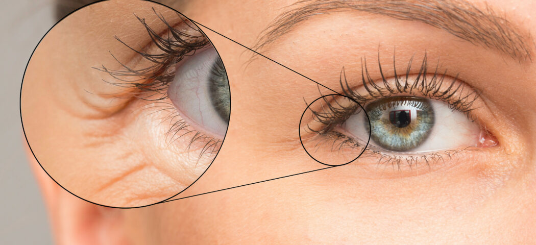 Come ridurre le rughe del contorno occhi con i prodotti giusti