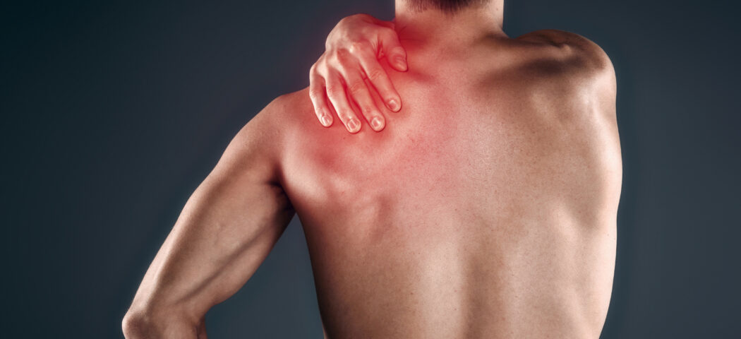 Rimedi contro dolori muscolari e articolari: creme, gel, cerotti